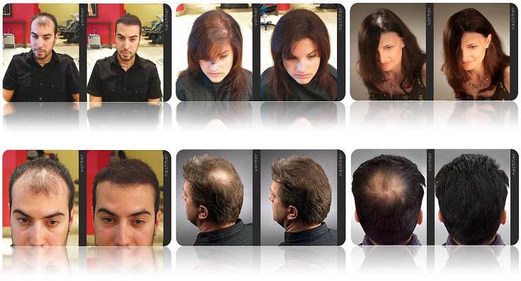 نمونه قبل و بعد استفاده از اسپری مو