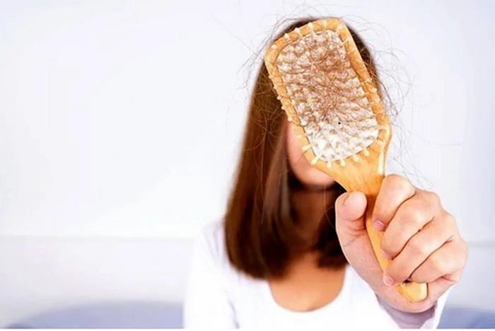 چگونه ریزش موی فصلی را درمان کنیم؟