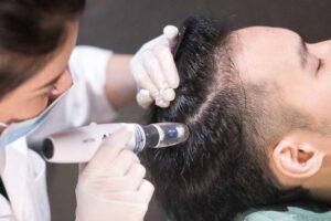 رونوفل تراپی چیست