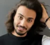 کاشت مو به روش HRT