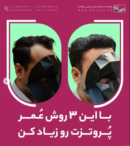 عمر پروتز مو رو زیاد کن
