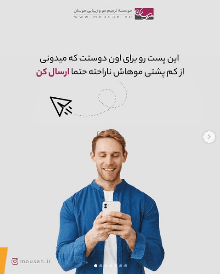 کم پشتی مو