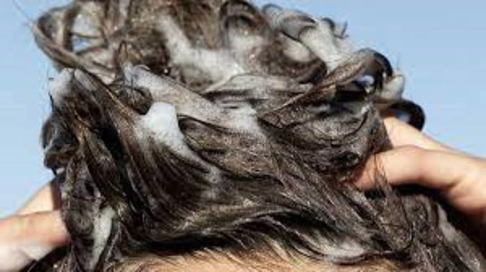 شامپو مخصوص پروتز مو