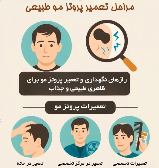 تعمیر پروتر مو