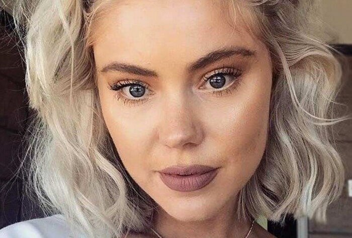 روش مایکروپوینت یا پروتز